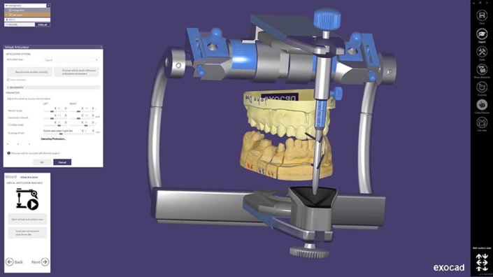 CAD Software - exocad