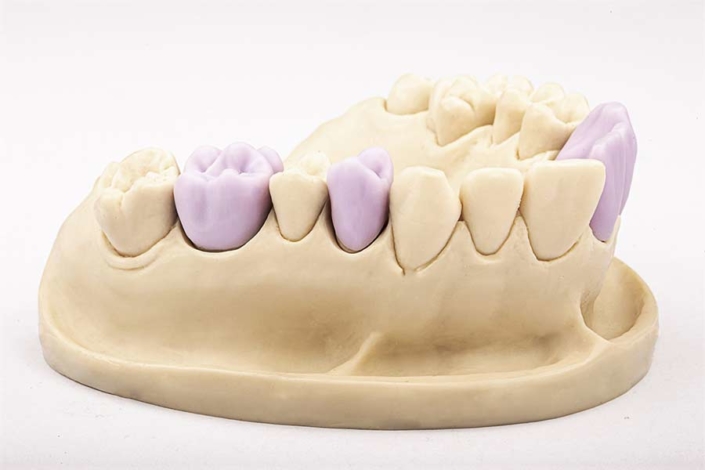 Cerec® All Ceramics