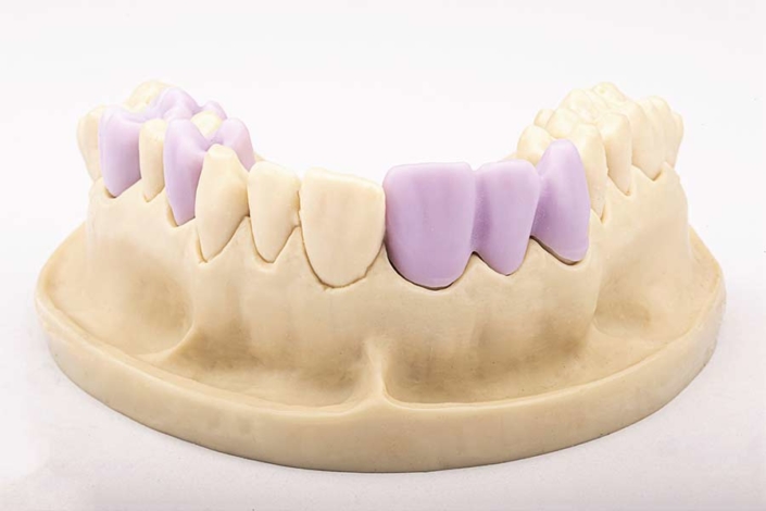 Cerec® All Ceramics