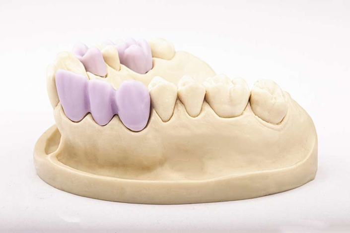 Cerec® All Ceramics