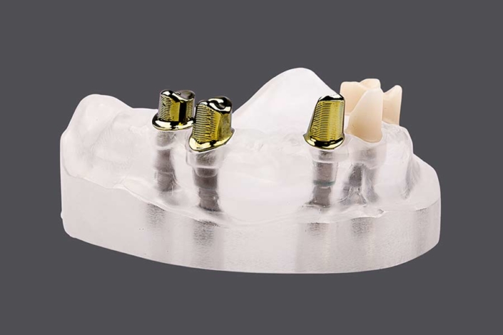 Individuelle Abutments