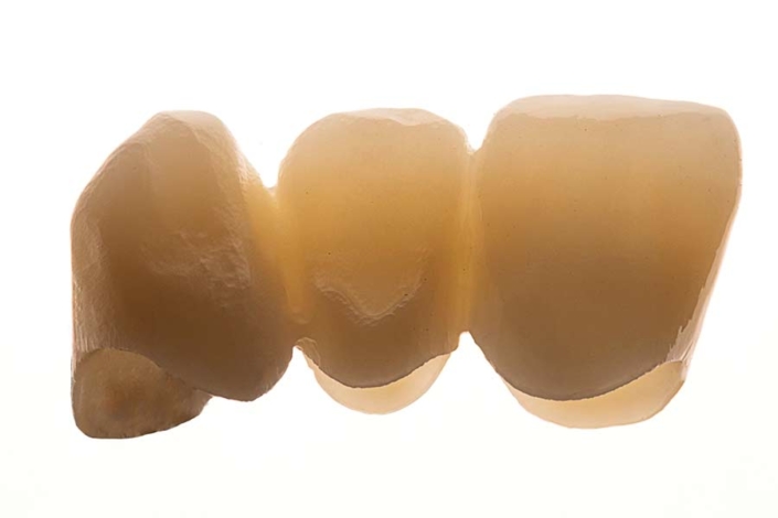 seramicCAM® Zirkon MultiSHT