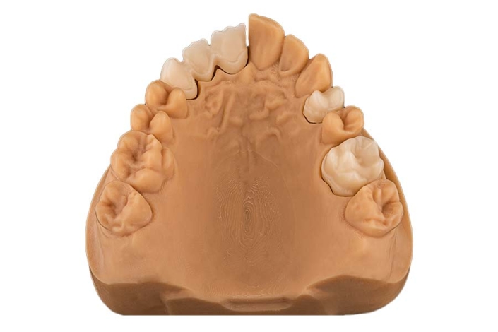 seramicCAM® Zirkon MultiSHT