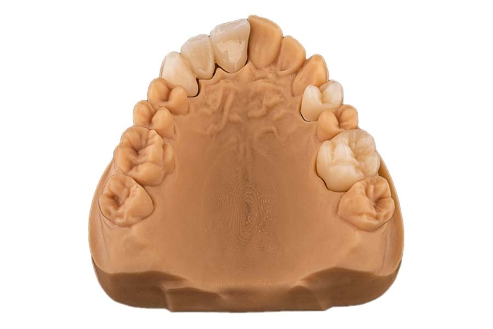 seramicCAM® Zirkon MultiSHT