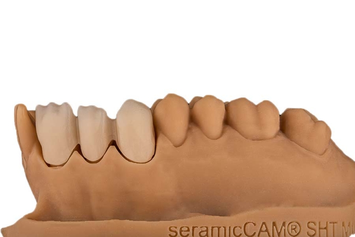 seramicCAM® Zirkon MultiSHT