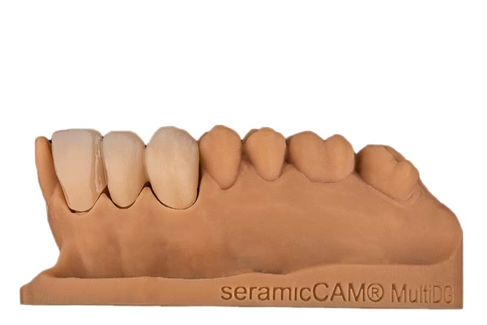 seramicCAM® Zirkon MultiDG