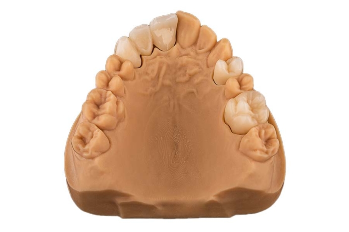 seramicCAM® Zirkon MultiDG