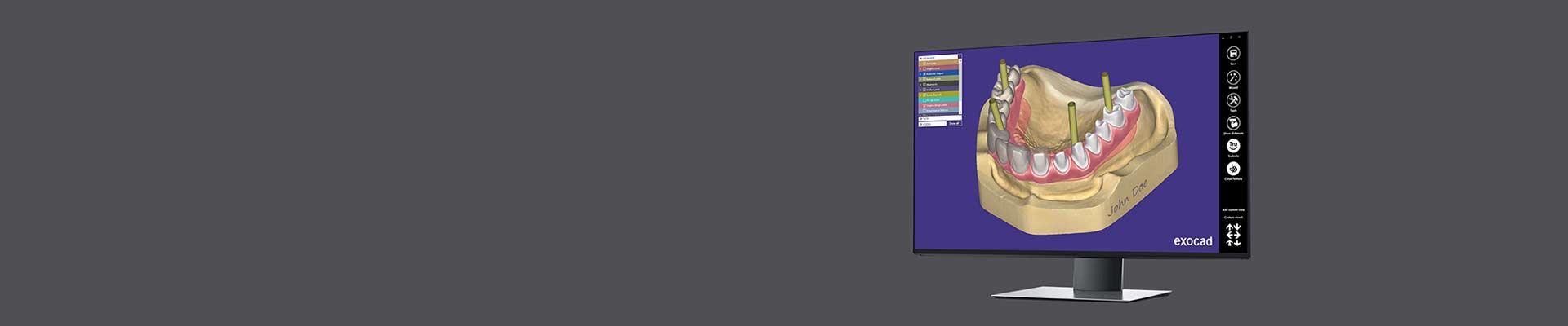 CAD Software - exocad